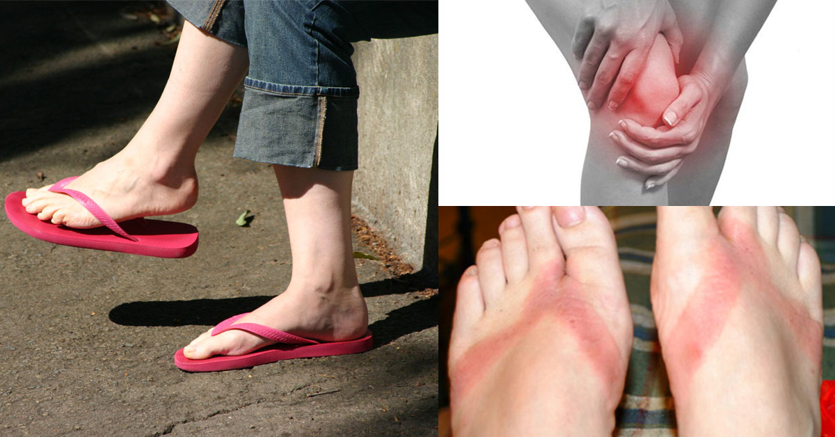 Dép tông có thể khiến khớp cổ chân của bạn bị lệch nếu đi sai cách
